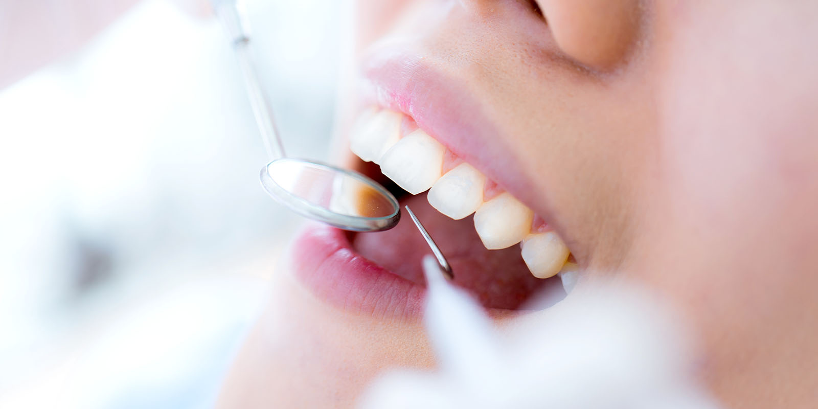当院の審美歯科の特徴
